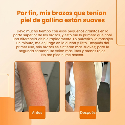 Exfoliante corporal spray con ácido kójico y cúrcuma - vista 9